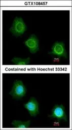 Anti-PF4V1 antibody [N3C3] used in Immunocytochemistry/ Immunofluorescence (ICC/IF). GTX108457