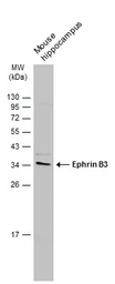 Anti-Ephrin B3 antibody [C2C3], C-term used in Western Blot (WB). GTX108485