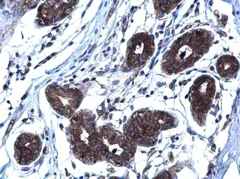Anti-RANKL antibody [C2C3], C-term used in IHC (Paraffin sections) (IHC-P). GTX108515