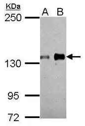 Anti-AXL antibody used in Western Blot (WB). GTX108560
