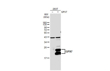 Anti-GPX7 antibody used in Western Blot (WB). GTX108578