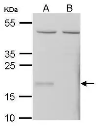 Anti-GPX7 antibody used in Western Blot (WB). GTX108578