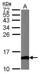 Anti-Cytochrome C antibody used in Western Blot (WB). GTX108585