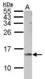 Anti-Cytochrome C antibody used in Western Blot (WB). GTX108585