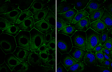 Anti-ZO-1 antibody used in Immunocytochemistry/ Immunofluorescence (ICC/IF). GTX108592