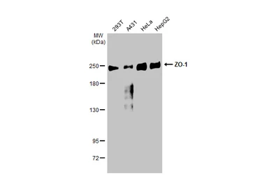 Anti-ZO-1 antibody [N1N2], N-term used in Western Blot (WB). GTX108613