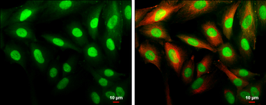 Anti-Cyclin D1 antibody [N1C3] used in Immunocytochemistry/ Immunofluorescence (ICC/IF). GTX108624