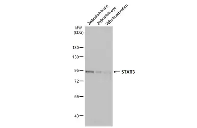 Anti-STAT3 antibody used in Western Blot (WB). GTX108630