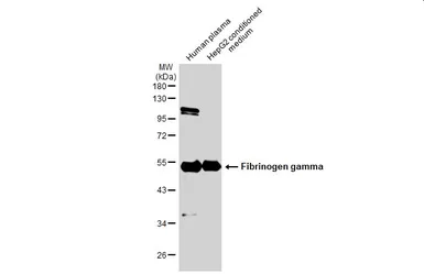 Anti-Fibrinogen gamma antibody used in Western Blot (WB). GTX108640