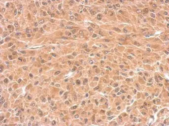 Anti-DCTD antibody used in IHC (Paraffin sections) (IHC-P). GTX108663