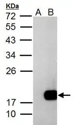 Anti-DCTD antibody used in Western Blot (WB). GTX108663