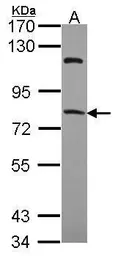 Anti-RFX4 antibody used in Western Blot (WB). GTX108667