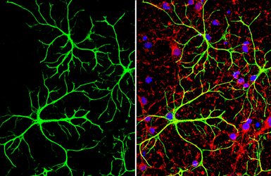 Anti-GFAP antibody used in Immunocytochemistry/ Immunofluorescence (ICC/IF). GTX108711