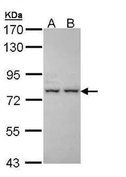 Anti-ALS antibody [C1C3-2] used in Western Blot (WB). GTX108718