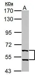 Anti-TrxR1 antibody [N3C2], Internal used in Western Blot (WB). GTX108727
