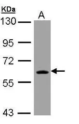 Anti-TrxR1 antibody [N3C2], Internal used in Western Blot (WB). GTX108727