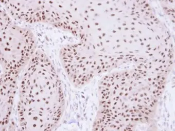 Anti-RPA70 antibody [C1C3] used in IHC (Paraffin sections) (IHC-P). GTX108749
