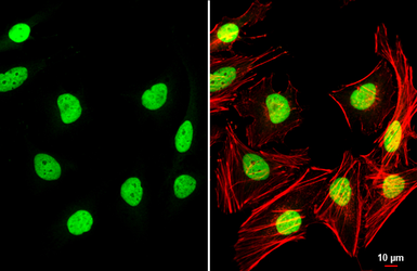 Anti-TEAD4 antibody used in Immunocytochemistry/ Immunofluorescence (ICC/IF). GTX108750