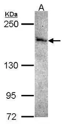 Anti-STK36 antibody [N1N2], N-term used in Western Blot (WB). GTX108794
