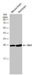 Anti-DLX1 antibody [N1C3-2] used in Western Blot (WB). GTX108804