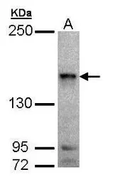 Anti-MAP4K6 antibody [C2C3-2], C-term used in Western Blot (WB). GTX108816