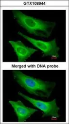 Anti-TNNI3K antibody [N2C1], Internal used in Immunocytochemistry/ Immunofluorescence (ICC/IF). GTX108944