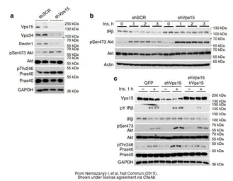 Anti-PI3 kinase p150 antibody [C1C3] used in Western Blot (WB). GTX108953