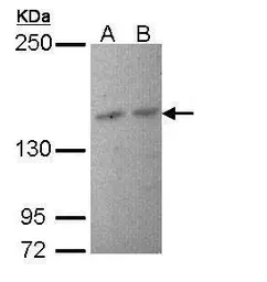 Anti-PI3 kinase p150 antibody [C1C3] used in Western Blot (WB). GTX108953