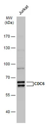 Anti-CDC6 antibody used in Western Blot (WB). GTX108979