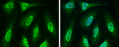 Anti-CDC6 antibody used in Immunocytochemistry/ Immunofluorescence (ICC/IF). GTX108979