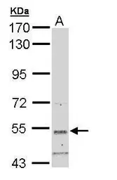 Anti-SNTB2 antibody [N2C3-2] used in Western Blot (WB). GTX108987