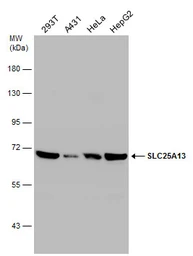 Anti-SLC25A13 antibody [N3C2], Internal used in Western Blot (WB). GTX109001