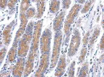 Anti-HSD17B6 antibody [N1C3] used in IHC (Paraffin sections) (IHC-P). GTX109009