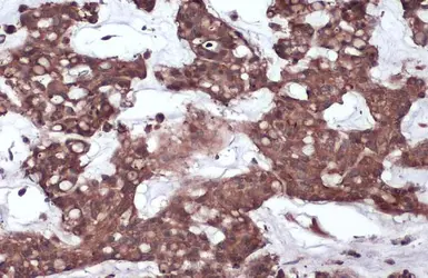 Anti-CD130 antibody used in IHC (Paraffin sections) (IHC-P). GTX109048