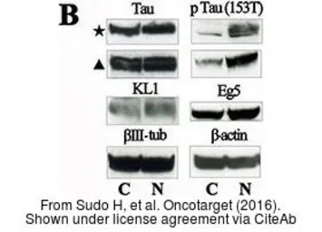 Anti-Eg5 antibody [C2C3], C-term used in Western Blot (WB). GTX109054