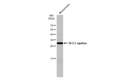 Anti-14-3-3 epsilon antibody [N1C3] used in Western Blot (WB). GTX109090