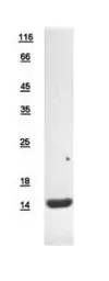 Human L-FABP protein, His tag. GTX109142-pro