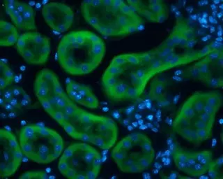 Anti-L-FABP antibody [N1C3] used in IHC (Frozen sections) (IHC-Fr). GTX109142