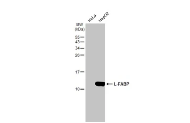 Anti-L-FABP antibody [N1C3] used in Western Blot (WB). GTX109142