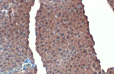 Anti-L-FABP antibody [N1C3] used in IHC (Paraffin sections) (IHC-P). GTX109142