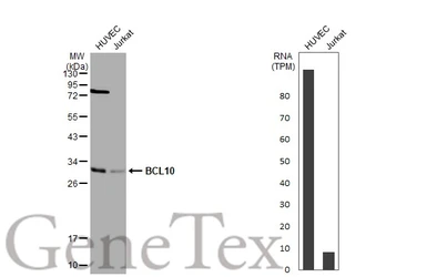 Anti-BCL10 antibody [N1C3] used in Western Blot (WB). GTX109159