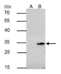 Anti-BCL10 antibody [N1C3] used in Immunoprecipitation (IP). GTX109159