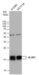 Anti-4E-BP1 antibody [N1C3] used in Western Blot (WB). GTX109162