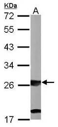 Anti-SBDS antibody [N1C3] used in Western Blot (WB). GTX109168