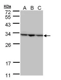Anti-SBDS antibody [N1C3] used in Western Blot (WB). GTX109168