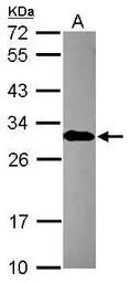 Anti-EN2 antibody used in Western Blot (WB). GTX109198
