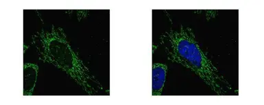 Anti-SUCLG1 antibody used in Immunocytochemistry/ Immunofluorescence (ICC/IF). GTX109215