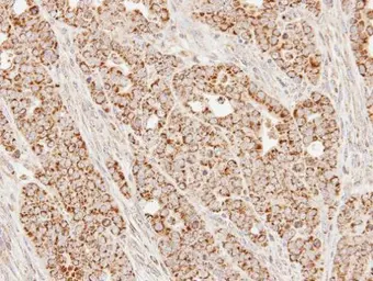 Anti-SUCLG1 antibody used in IHC (Paraffin sections) (IHC-P). GTX109215