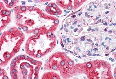 Anti-BCAP31 antibody, C-term used in IHC (Paraffin sections) (IHC-P). GTX10924