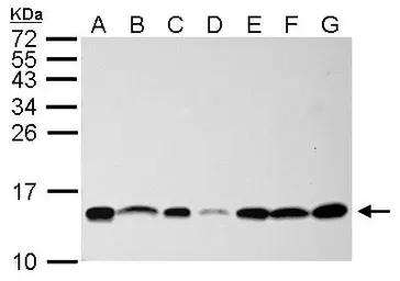 Anti-NHP2L1 antibody [N1C3] used in Western Blot (WB). GTX109247